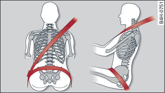 Fig. 253Colocación de la banda del hombro y de la banda abdominal