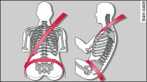 Colocación de la banda del hombro y de la banda abdominal